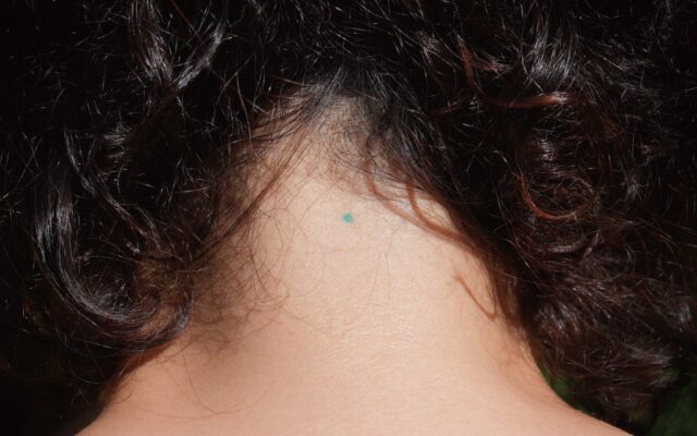 3000人以上の身体に刻まれた1mmの点。美術家・佐藤はなえによる《1mm tattoo》プロジェクトを記録したアートブック刊行決定